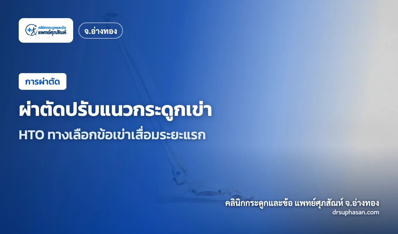 ภาพปกบทความ high-tibial-osteotomy