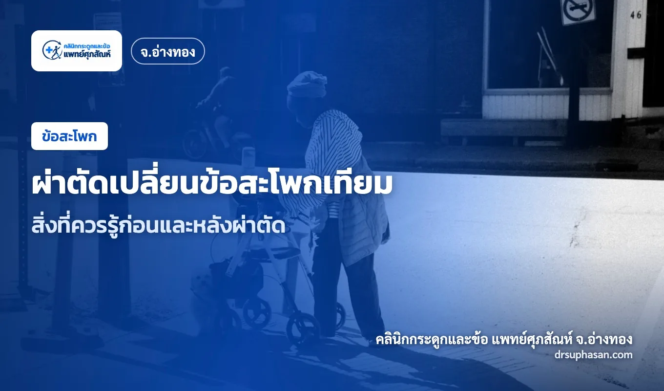ภาพปกบทความ total-hip-replacement