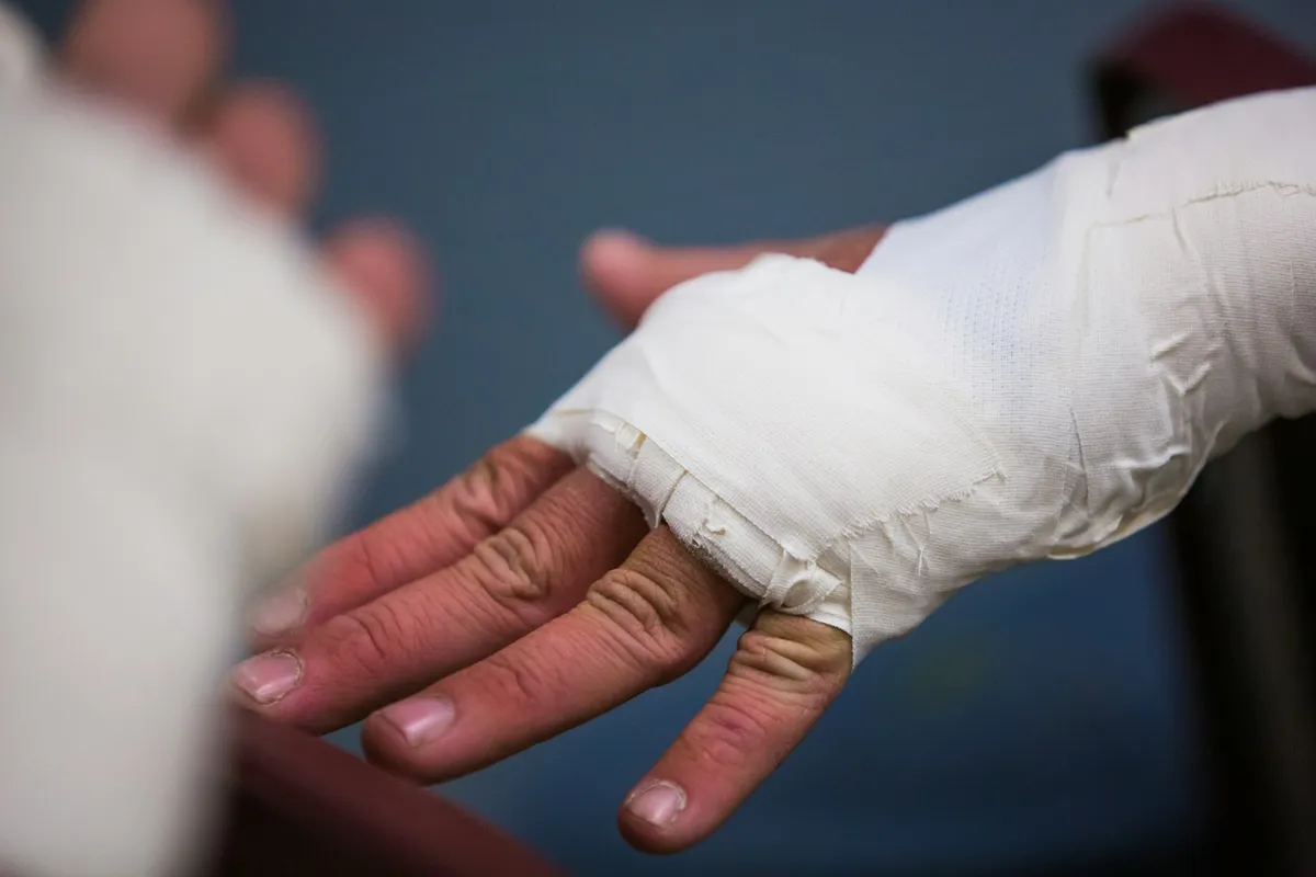 มือและข้อมือที่พันผ้าพันแผลสีขาว